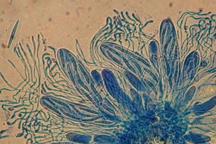 macrostoma