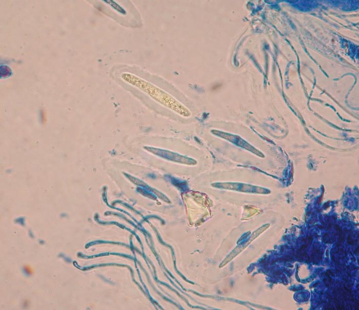 macrostoma