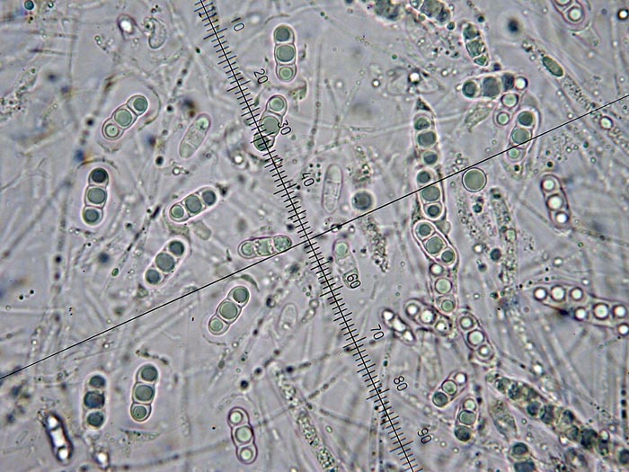 macrostoma