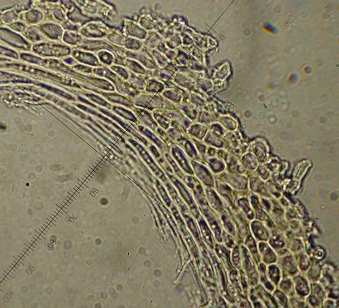 macrostoma
