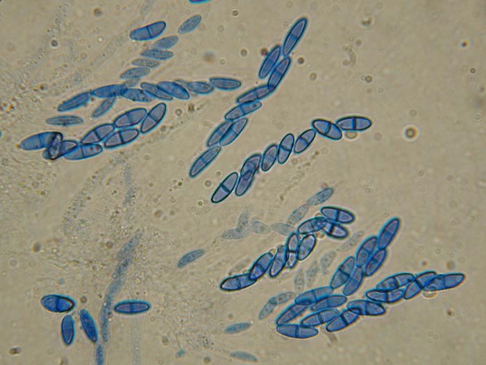 macrostoma