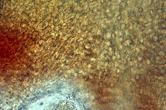 macrostoma