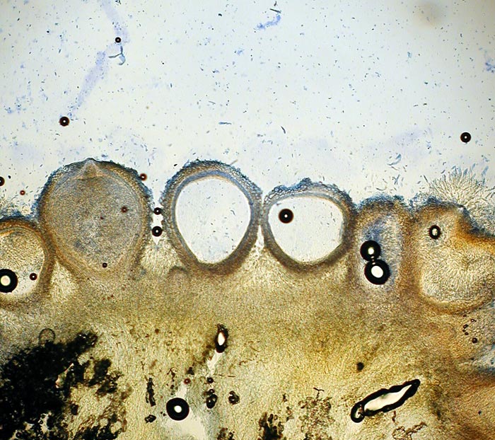 macrostoma
