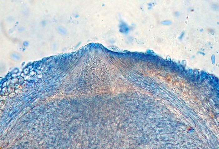 macrostoma