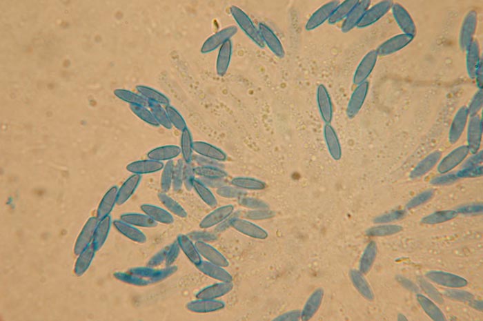 macrostoma