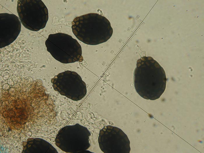 macrostoma