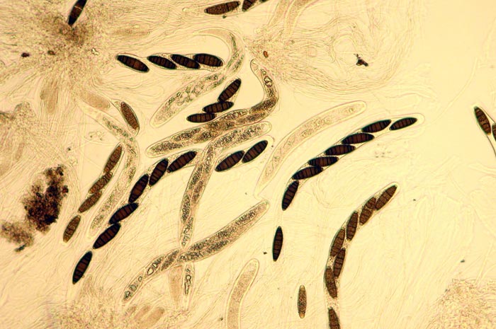 macrostoma