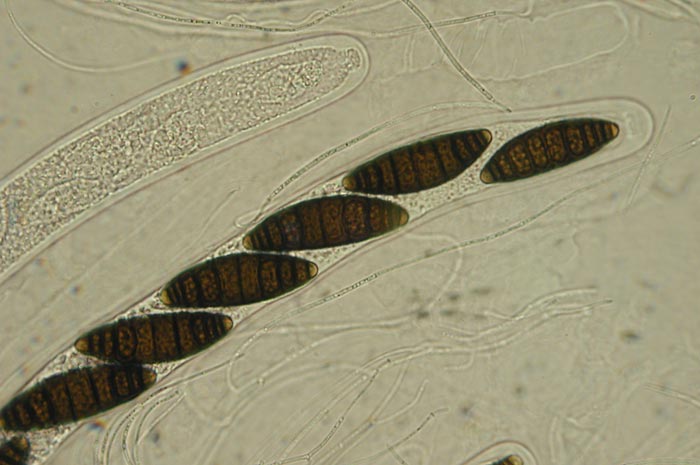 macrostoma