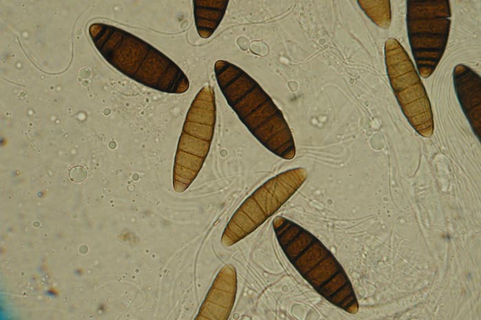 macrostoma