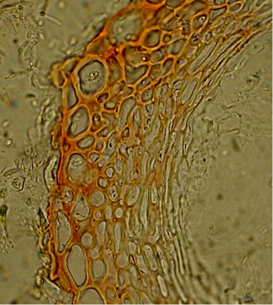 macrostoma