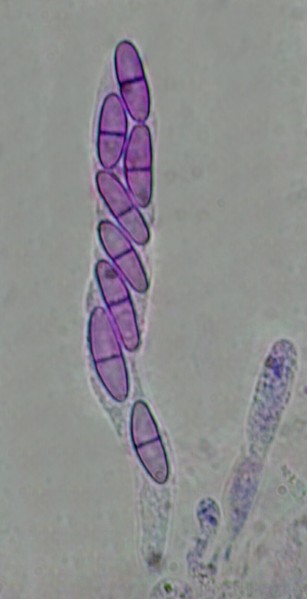 macrostoma