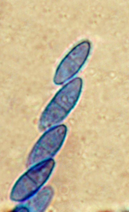 macrostoma