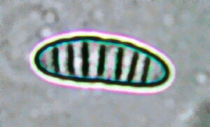 macrostoma