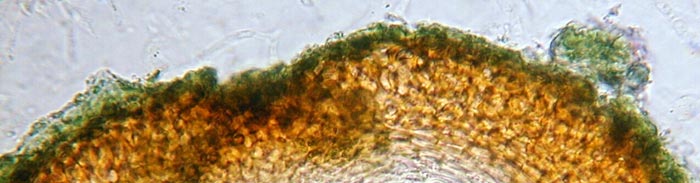 macrostoma
