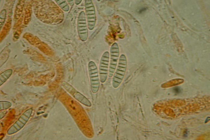 macrostoma