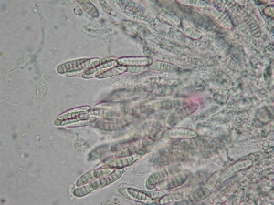 macrostoma