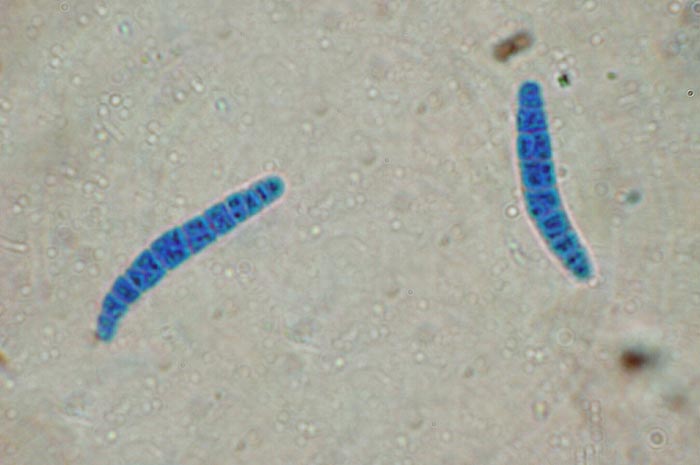 macrostoma