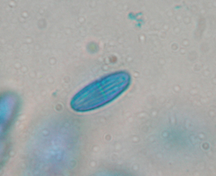 macrostoma