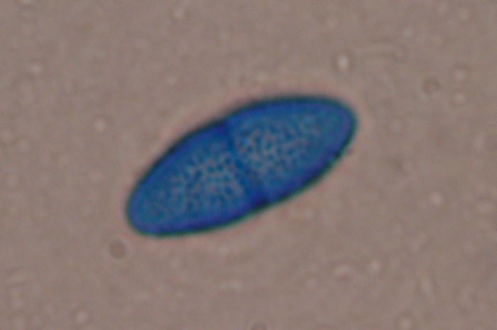 macrostoma