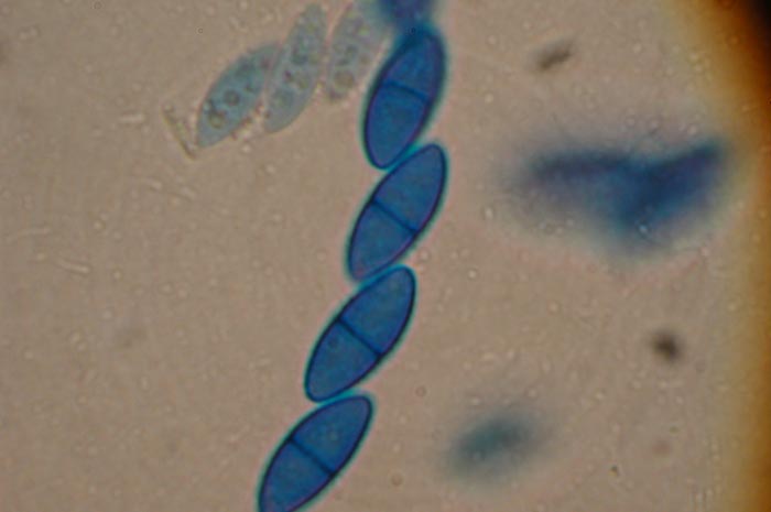 macrostoma