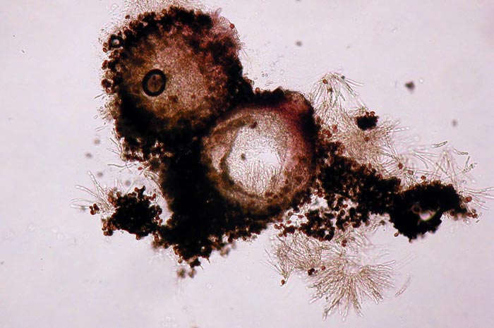 macrostoma