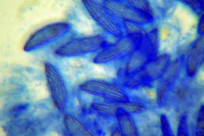 macrostoma