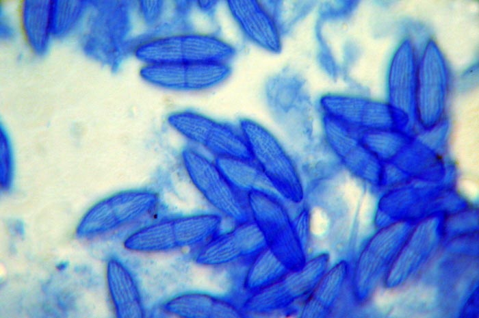 macrostoma
