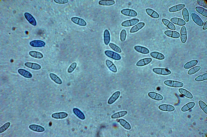 macrostoma