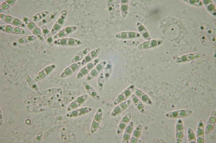 macrostoma