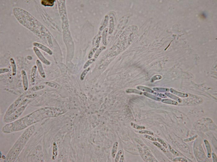 macrostoma