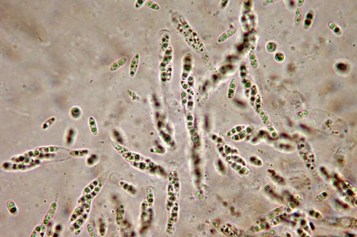 macrostoma