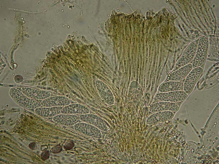 macrostoma