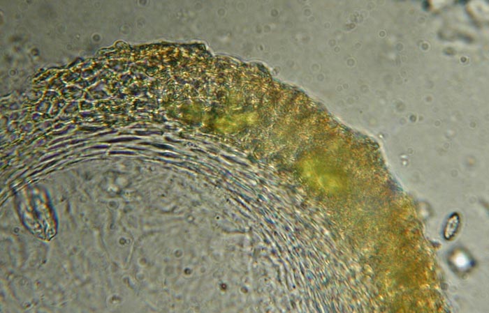 macrostoma