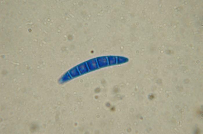 macrostoma