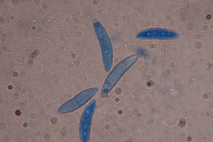 macrostoma