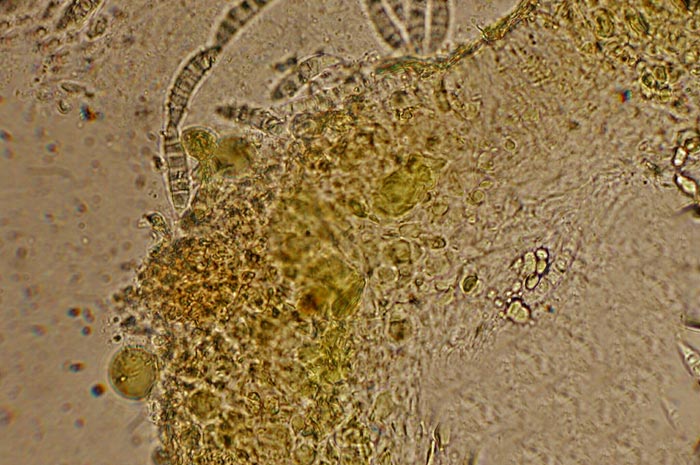 macrostoma