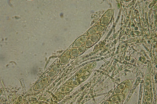 macrostoma