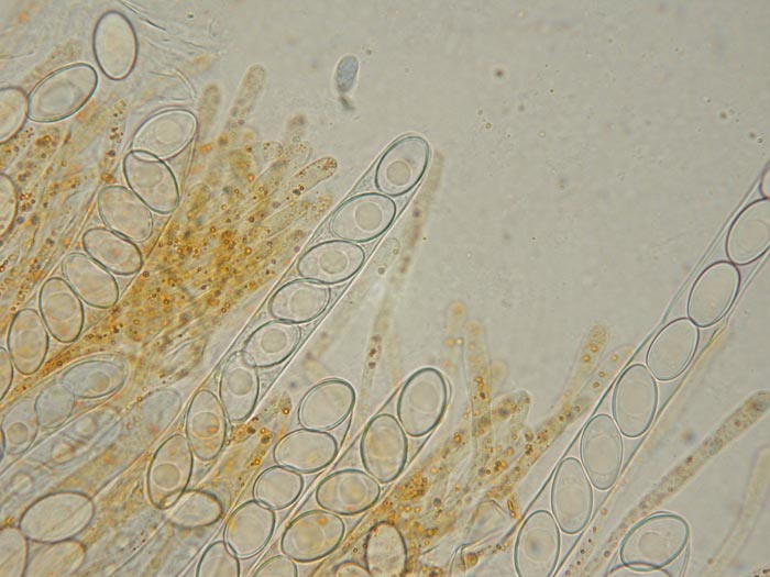 macrostoma
