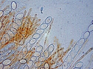 macrostoma