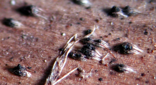 macrostoma