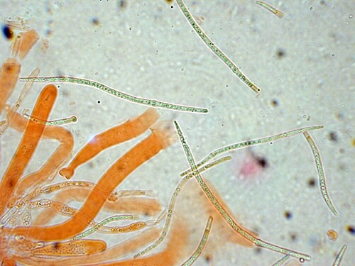 macrostoma