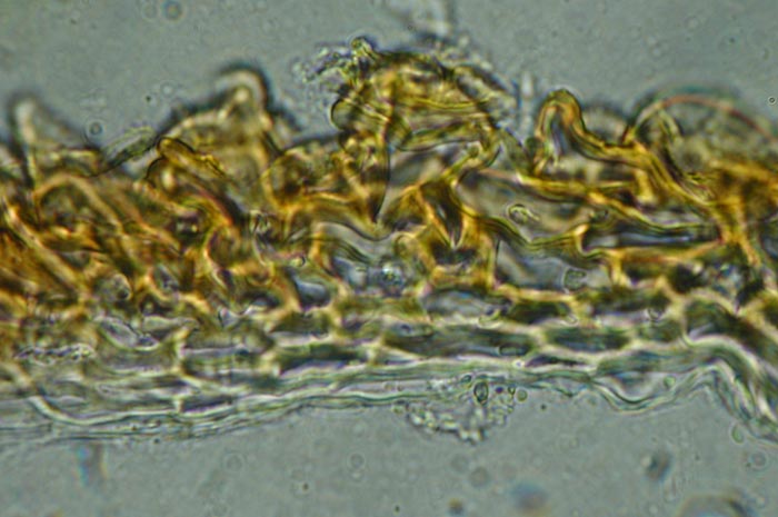 macrostoma