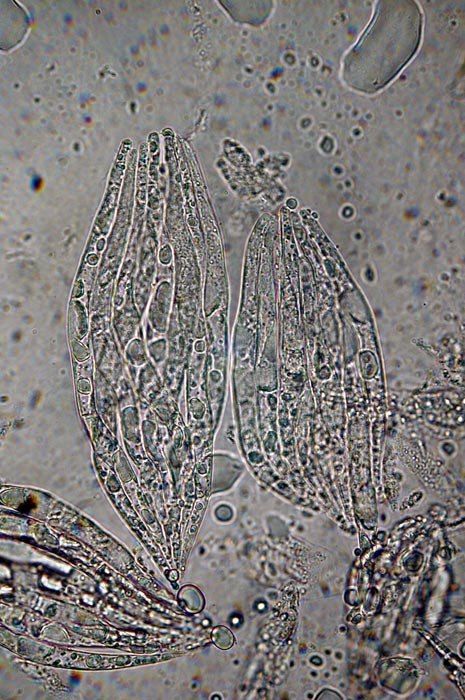 macrostoma