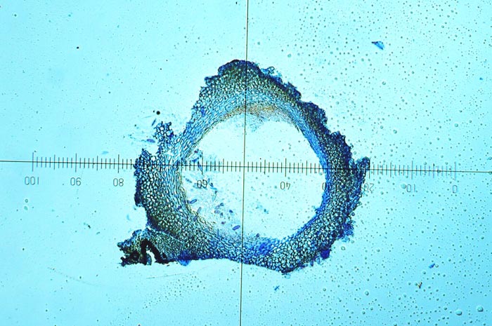 macrostoma