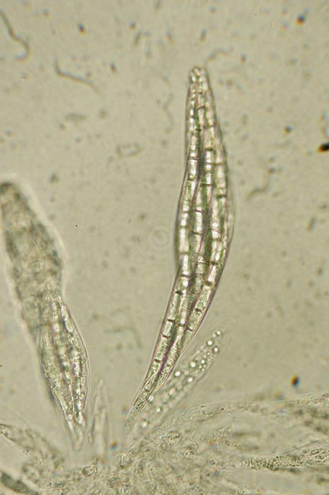 macrostoma
