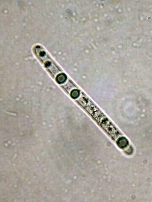 macrostoma