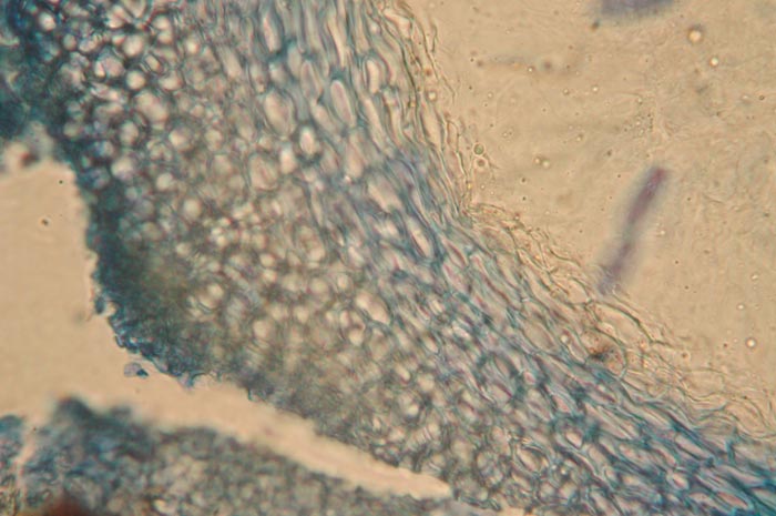 macrostoma