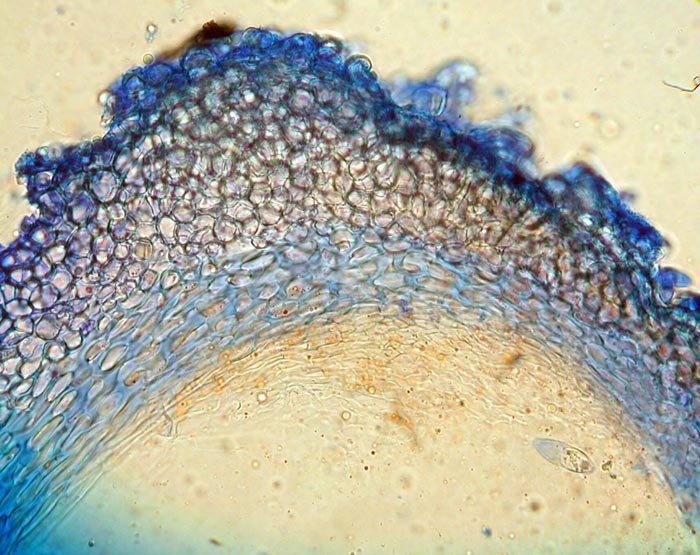 macrostoma