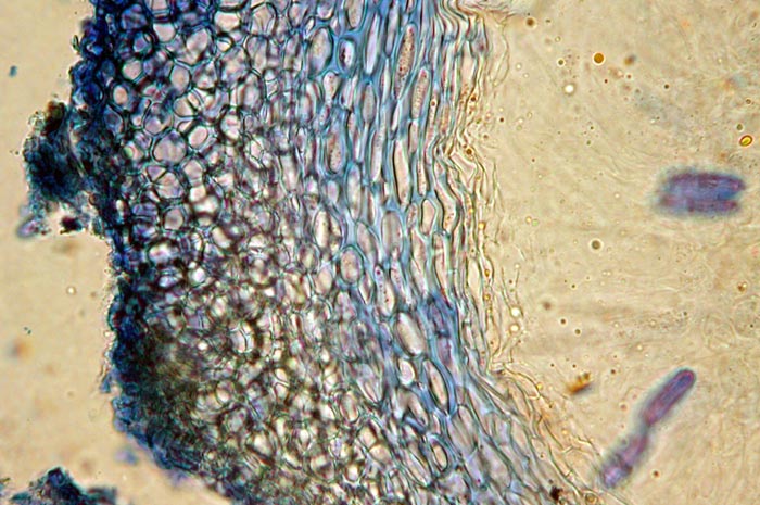 macrostoma