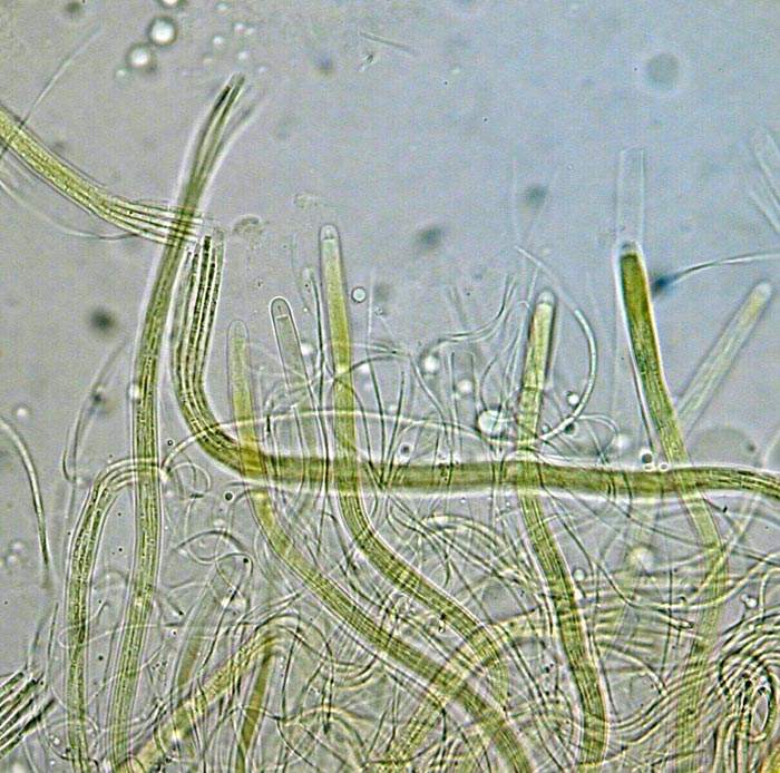 macrostoma